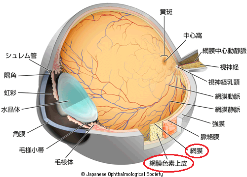 網膜色素変性 よくある目の病気 80 京橋クリニック眼科 大阪市都島区京橋駅前の眼科専門のクリニック